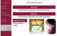 Automatisierte perkutane lumbale Diskotomie (APLD)