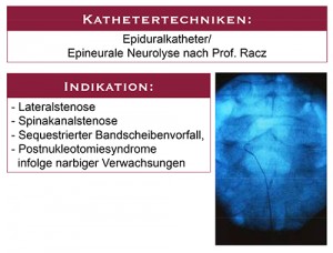 02-Kathetertechnik-1-300x228